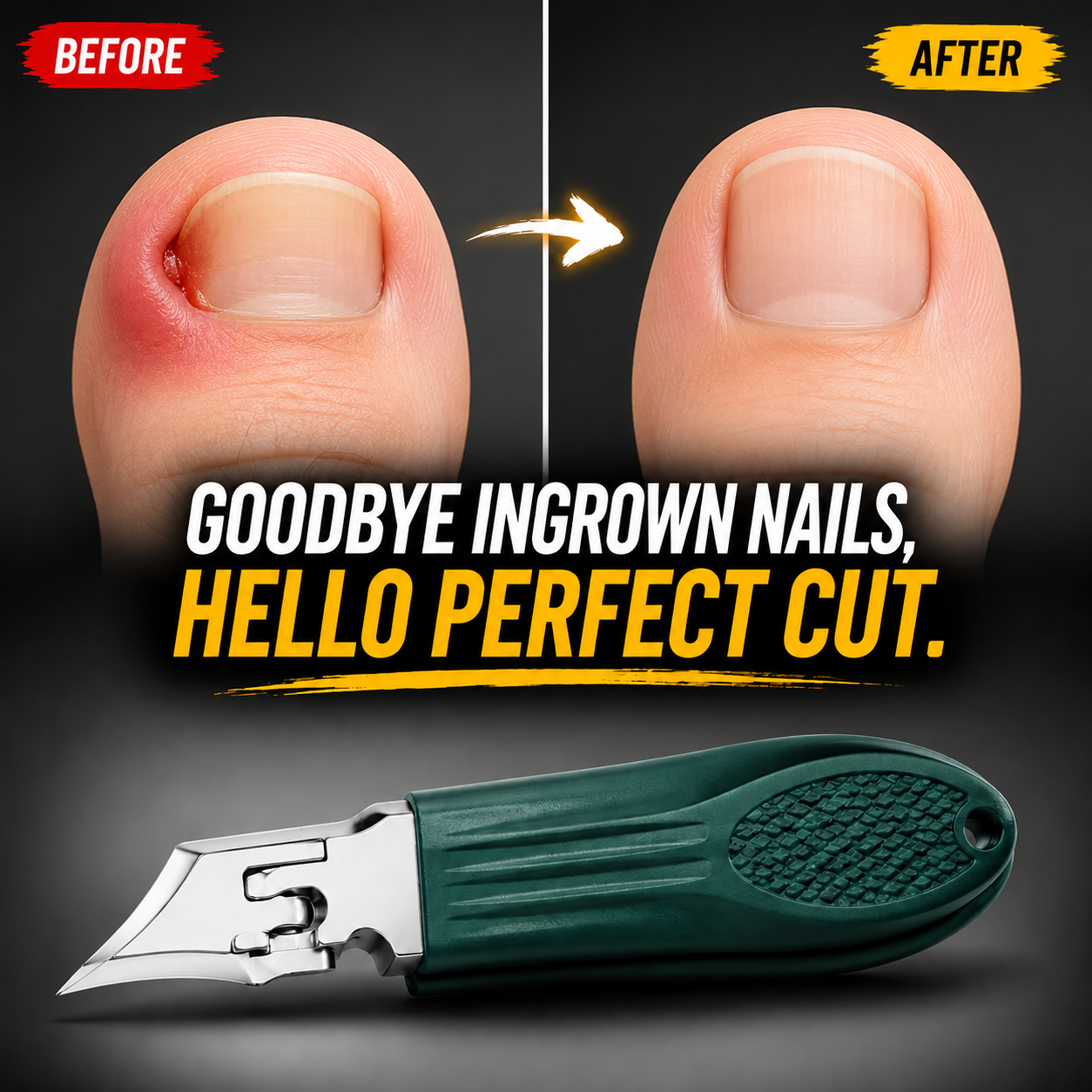 NailEdge Pro™