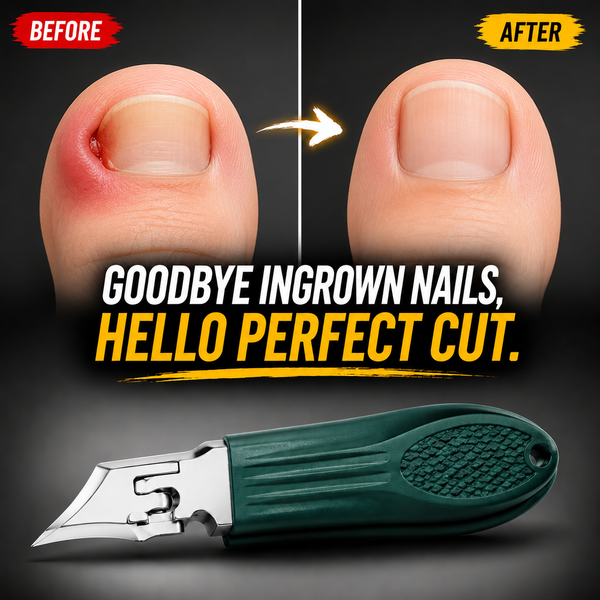NailEdge Pro™